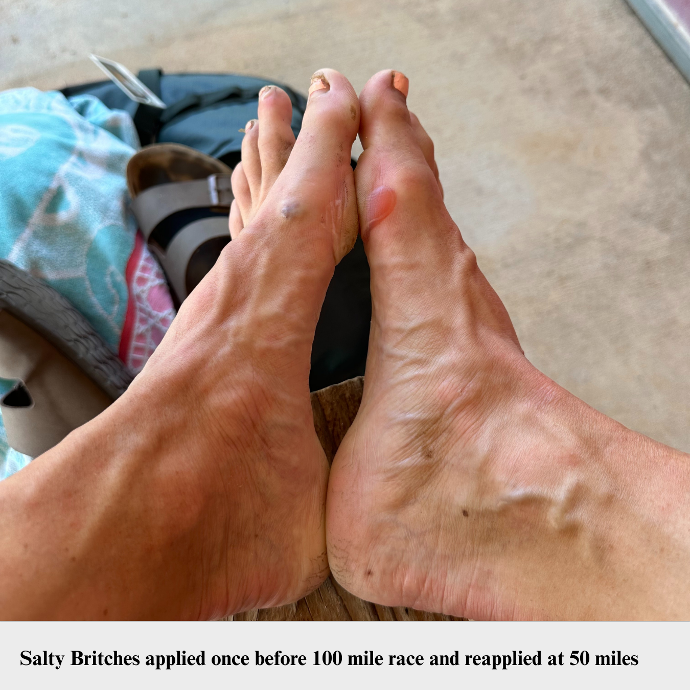 Salty Britches® Chafing Ointment
